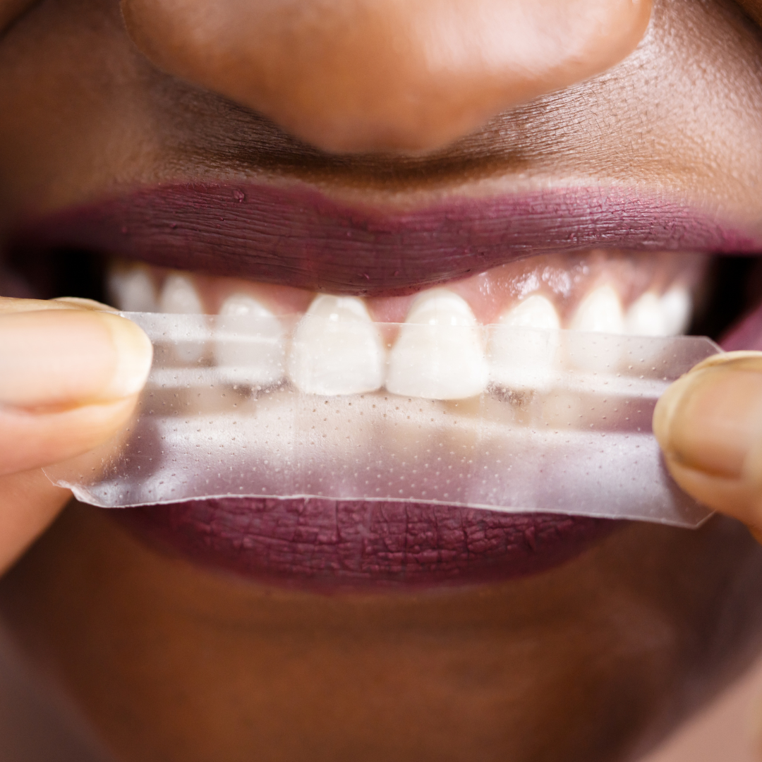 chemical and residue free teeth whitening strips